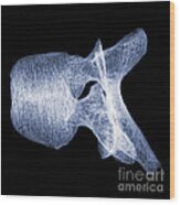 Human Vertebra T5, X-ray #6 Wood Print