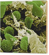 Yersinia Pestis Bacteria, Sem #7 Wood Print
