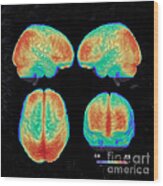 Bipolar Brain, 3d Mri Scan Wood Print