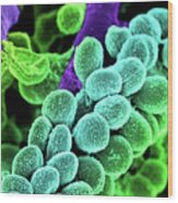 Streptococcus Bacteria - Colored Scanning Electron Micrograph. Wood Print