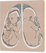 Unborn Baby #1 Wood Print
