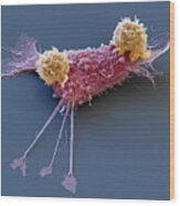 Breast Cancer Cell With Car T-cells, Sem Wood Print