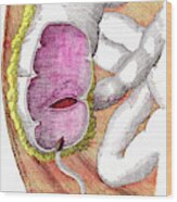 Caecum And Appendix Anatomy Wood Print
