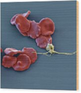 Erythrocytes And Thrombocytes, Sem Wood Print