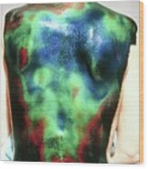 Liquid Crystal Thermography Of A Back Injury Wood Print