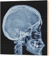 Normal Skull, X-ray Wood Print