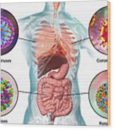 Viral Respiratory And Enteric Infections, Illustration #1 Wood Print