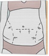 Midsection Of Woman With Marked Outlines On Abdomen Wood Print