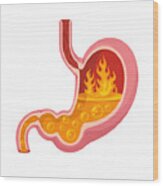 Stomach Heartburn Vector Wood Print