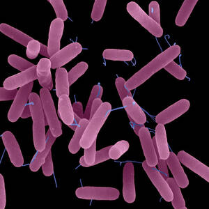 Lactobacillus rhamnosus bacteria, SEM - Stock Video Clip - K007/2739 -  Science Photo Library