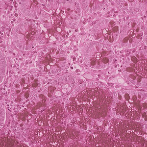 Small Intestine Lining #1 by Science Photo Library