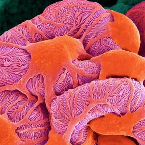 Kidney Glomerulus #11 by Science Photo Library