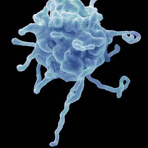 Activated Platelet #2 by Science Photo Library
