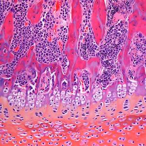 Bone Growth #2 by Science Photo Library