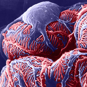 Kidney Glomerulus, Sem #3 by Don W Fawcett