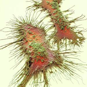 Microglia #2 by Science Photo Library
