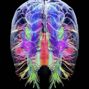 White matter fibres and brain, artwork #2 by Science Photo Library