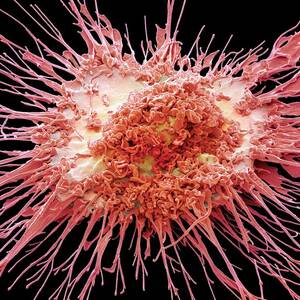 Dendritic Cell #6 by Science Photo Library