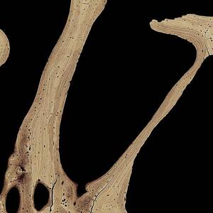 Bone Cross-section by Science Photo Library