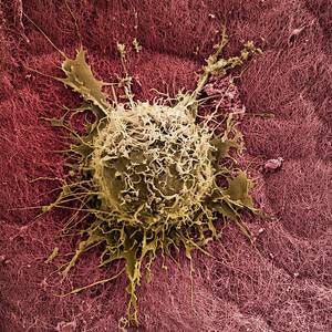 Bone Marrow Stem Cell On Cartilage by Science Photo Library