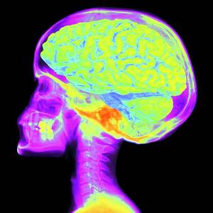 Brain Superimposed On Colour X-ray Of Human Skull by Science Photo Library
