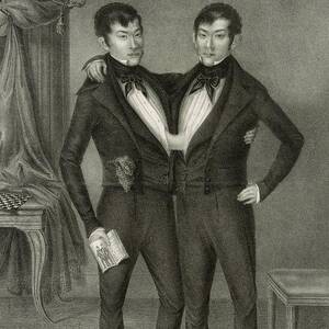 Chang And Eng Conjoined Twins by Science Photo Library