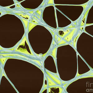 Chinese Lantern Flower Skeleton  SEM by Spl