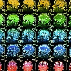 Coloured Mri Scans Of A Healthy Human Brain by Science Photo Library