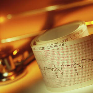 Ecg And Stethoscope by Science Photo Library