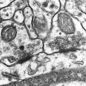 Excitatory Synapses On A Dendrite by Science Photo Library