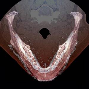 Lower Jaw And Teeth by Science Photo Library