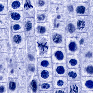 Mitosis, Onion Root Tip, Lm by Alvin Telser