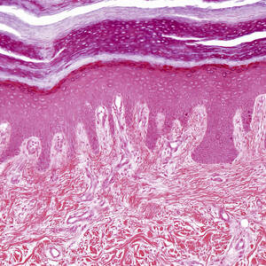 Plantar Skin, Lm by Alvin Telser