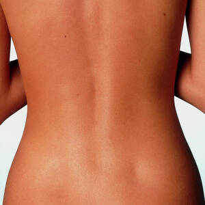Woman's Back: Posterior View Of The Torso by Science Photo Library
