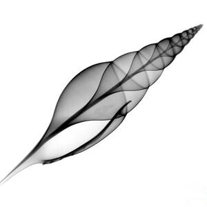 X-ray Of Martins Tibia by Bert Myers