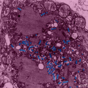 Rabies Virus, Tem #1 by Science Source