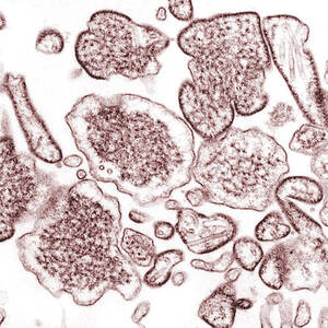 Nipah Virus #12 by Science Source