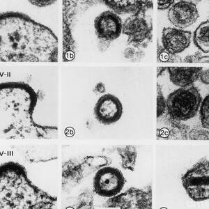 Aids Virus by Science Source