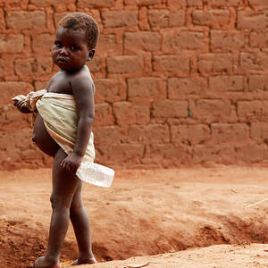 Malnourished Child Being Fed Photograph by Mauro Fermariello/science ...