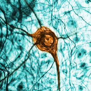 Neuron, Tem #1 by Science Source