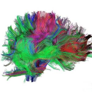 Brain Fibres Side View Right by Science Photo Library