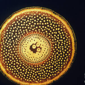 Section Through Root Of Screw Pine by Science Photo Library