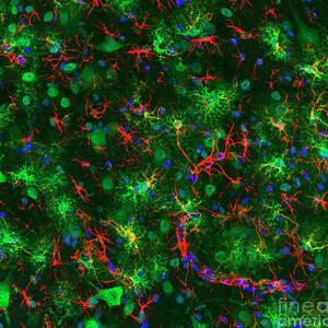 Spinal Cord by Science Photo Library