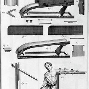 Breast Surgery, 1751-1777 by Print Collector