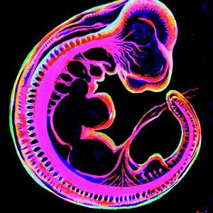 Embryo with placenta Painting by Chirila Corina - Fine Art America