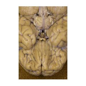 Human Brain Inferior View