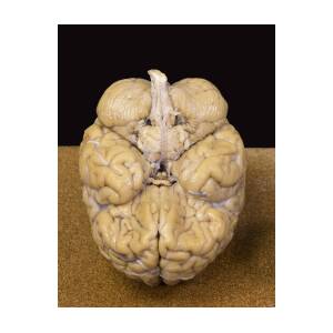 Human Brain Inferior View