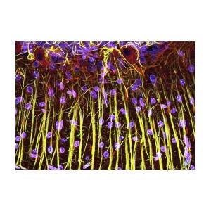 Purkinje Nerve Cells In The Cerebellum Greeting Card for Sale by Thomas ...